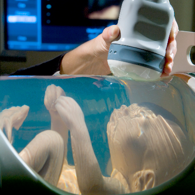 Fetal Ultrasound Training